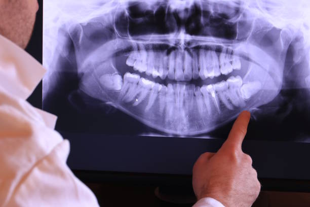 Best Emergency Root Canal Therapy in La Crosse, KS
