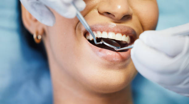 Best Emergency Treatment for Oral Infections in La Crosse, KS
