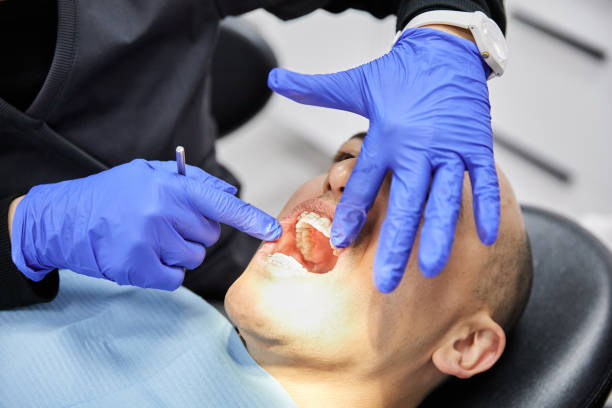 Best Emergency Care for Gum Disease in La Crosse, KS